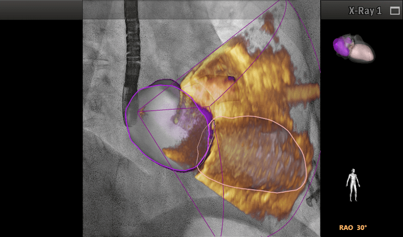 Nueva sala de hemodinamia, Informaci�n para especialidad de cardiolog�a